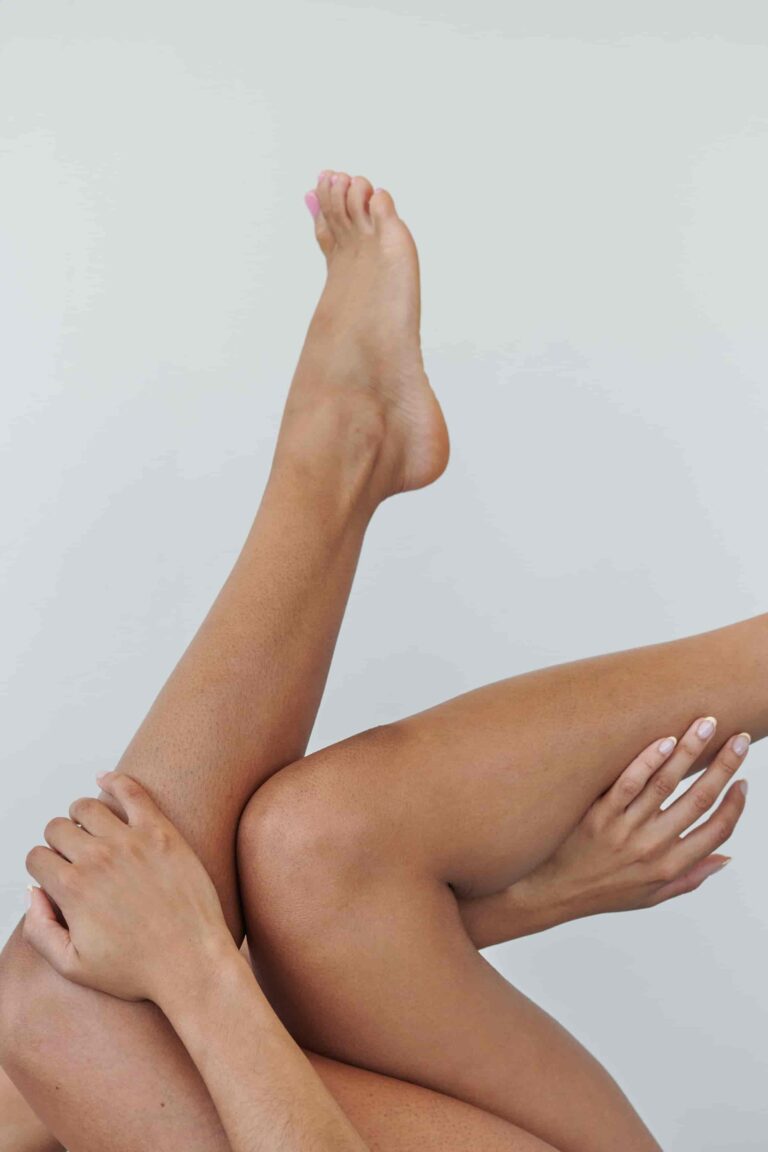 cellulite sur les jambes